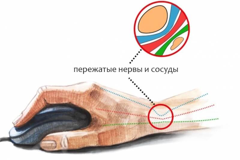 Кракен не работает сайт